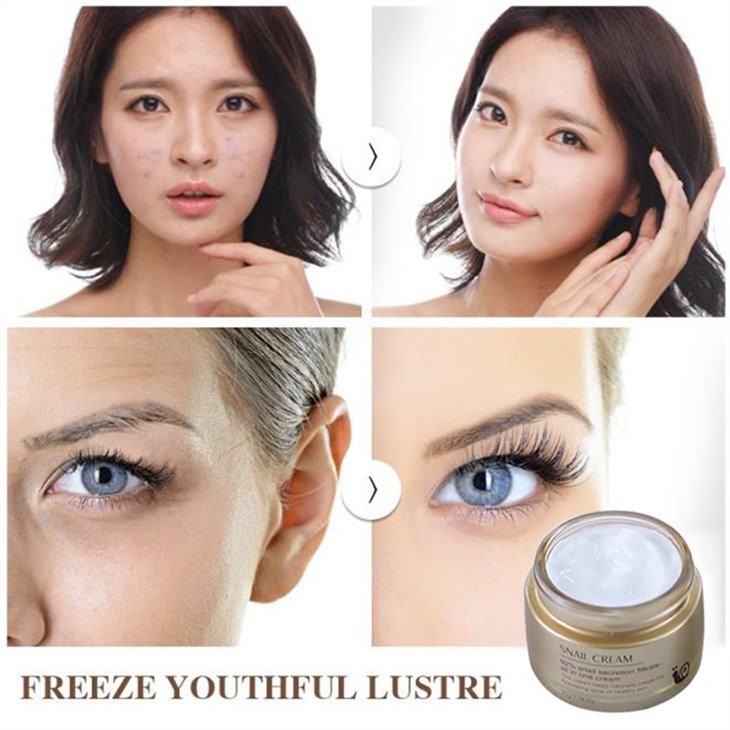 snail cream for dark spots